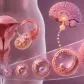 Penyebab Infertilitas Wanita: Gangguan Ovulasi, Tuba Falopi, Endometriosis