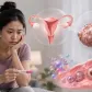 PCOS dan Kehamilan: Tantangan Kesuburan Wanita